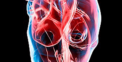 Peripheral Vascular Blockage/PAD